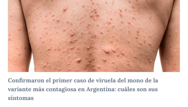 Detectan el primer caso del clado más agresivo de viruela del mono